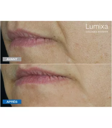 Lumixa • FB Dermatology