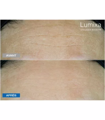 Lumixa • FB Dermatology