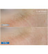 Lumixa • FB Dermatology