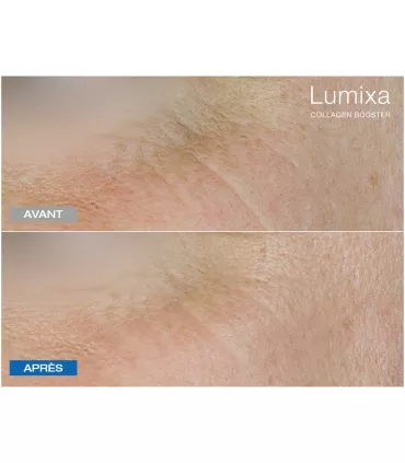 Lumixa • FB Dermatology