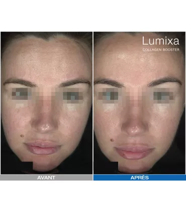 Lumixa • FB Dermatology